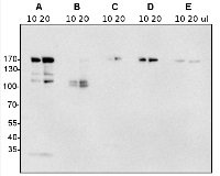 Clathrin heavy-chain 1,2  in the group Antibodies Plant/Algal  / Zea mays at Agrisera AB (Antibodies for research) (AS10 690)